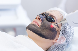 Laser hollywood peel